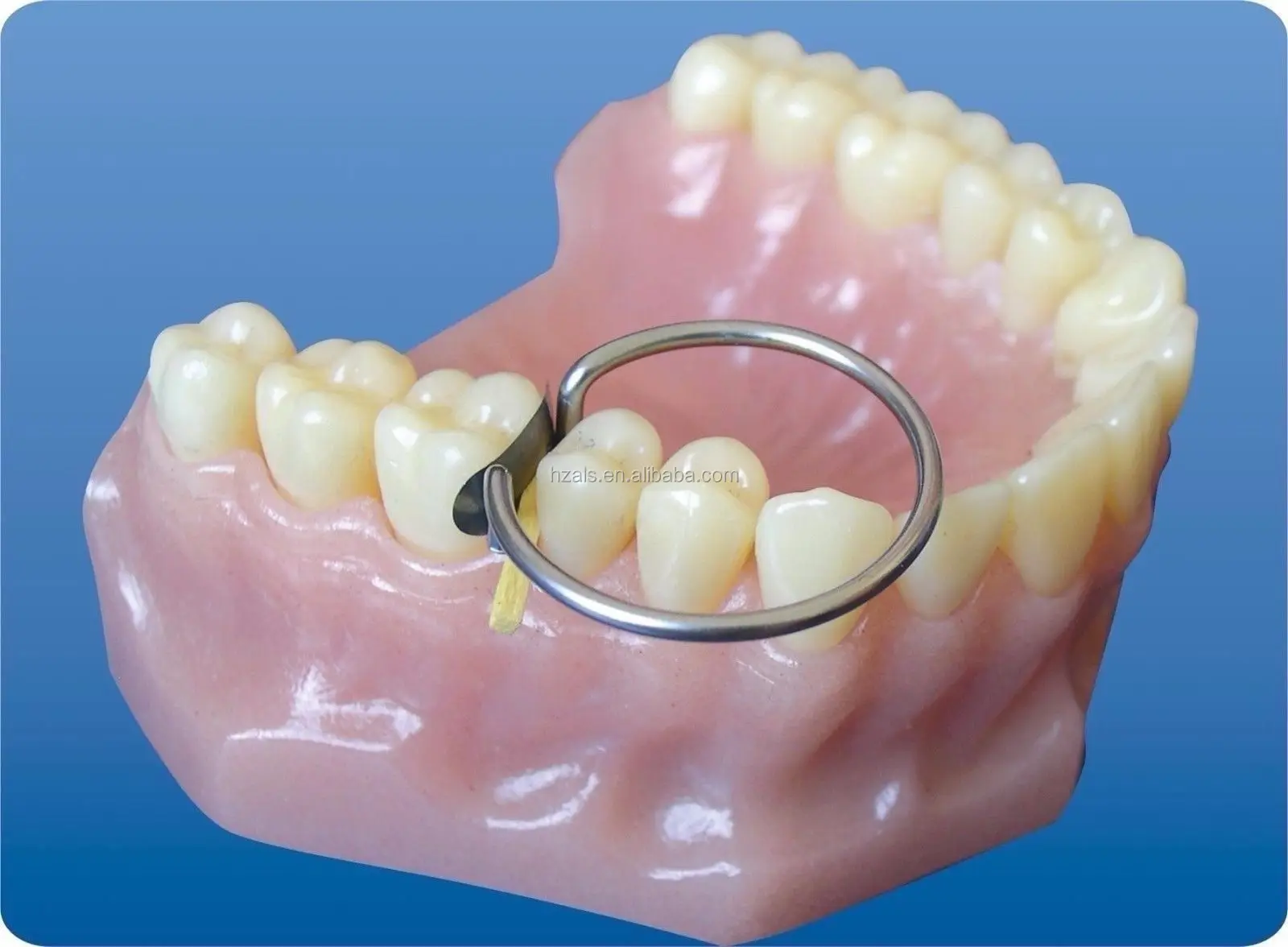 100 Pcs 35 Um Hard Sectional Matrix Band/contoured Matrix Bands/dental