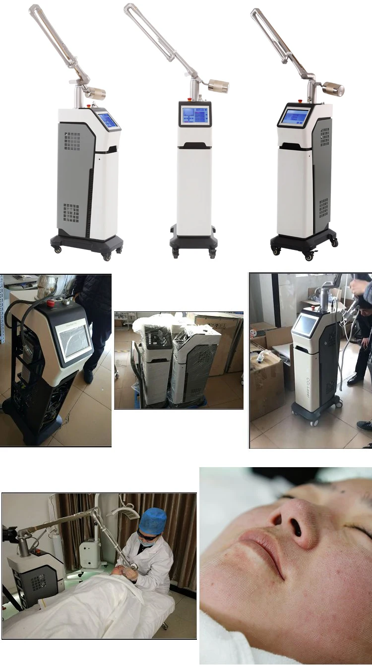 co2 laser detail.jpg