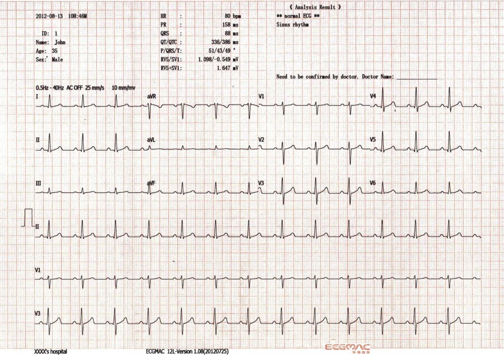 Top 12 Channel Ecg Machine Em-1203 - Buy Portable Ecg Machine,12 Lead ...