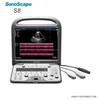 SonoScape S8 Factory price Expert Portable Ultrasound machine with advanced software kits and 2 probes
