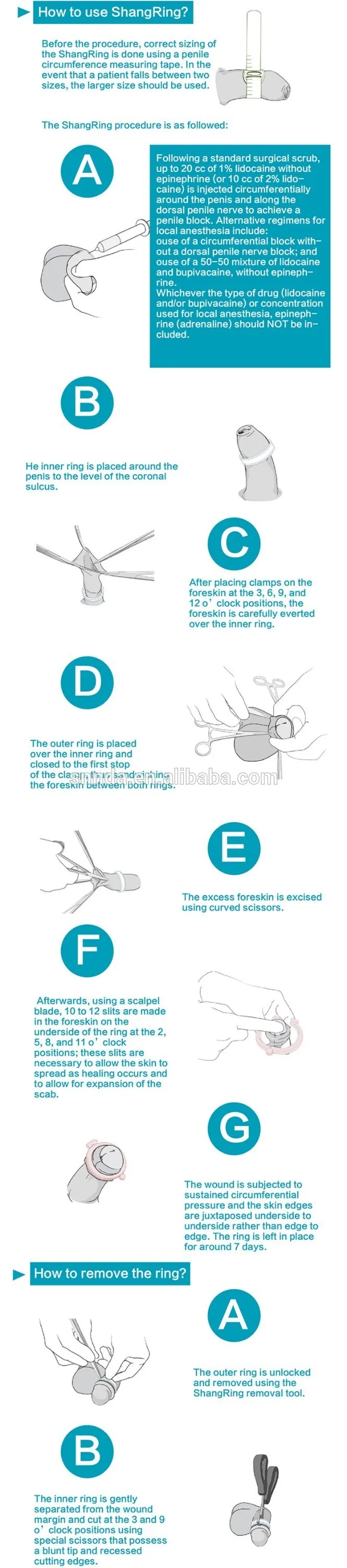 Disposable Shang Ring Male Circumcision Buy Disposable Medical