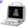 China Ecografo 4D, Portable Ultrasound Machine 3D 4D