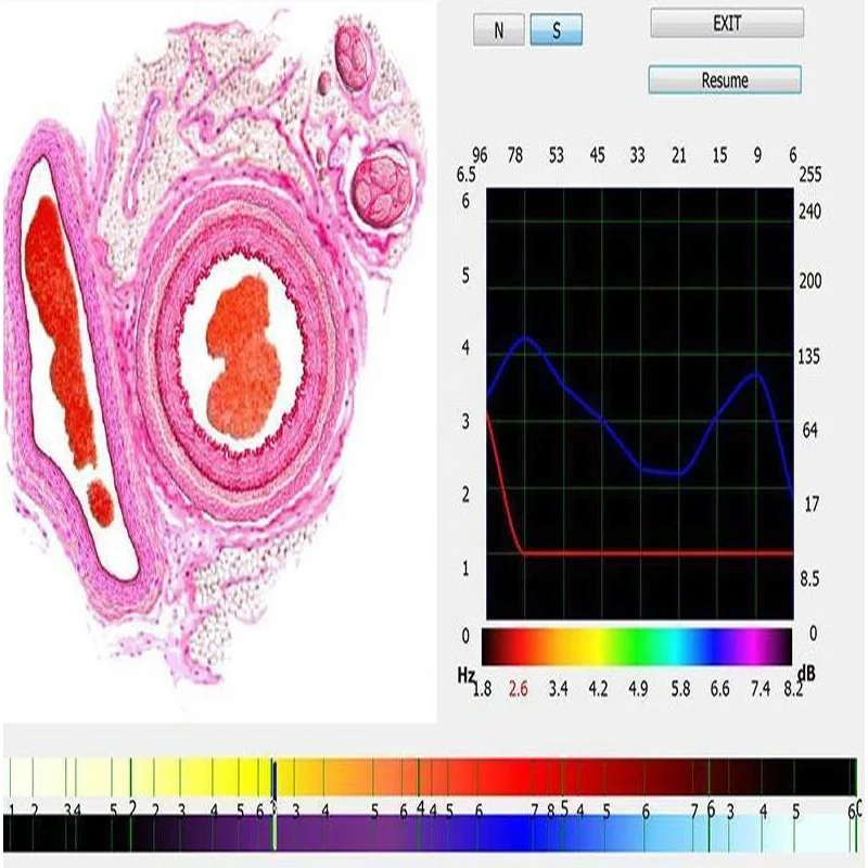 Hot selling Health Body Scanner Bioresonance Analyzer Bioplasm 9d Nls