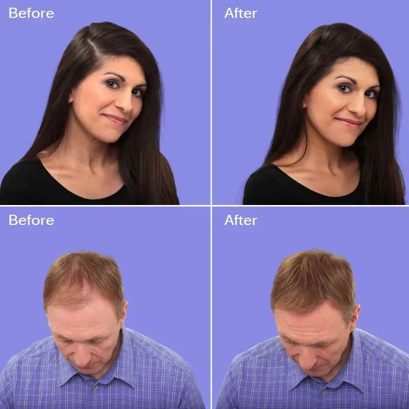 How To Grow Hair Faster And Cure Hair Loss Or Alopecia Problem Professional Shampoo 30 Days Hair