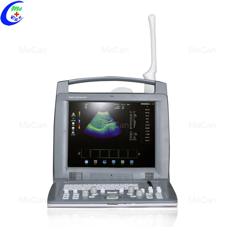 Portable 2D Echo Machine Echocardiography Machine, View portable