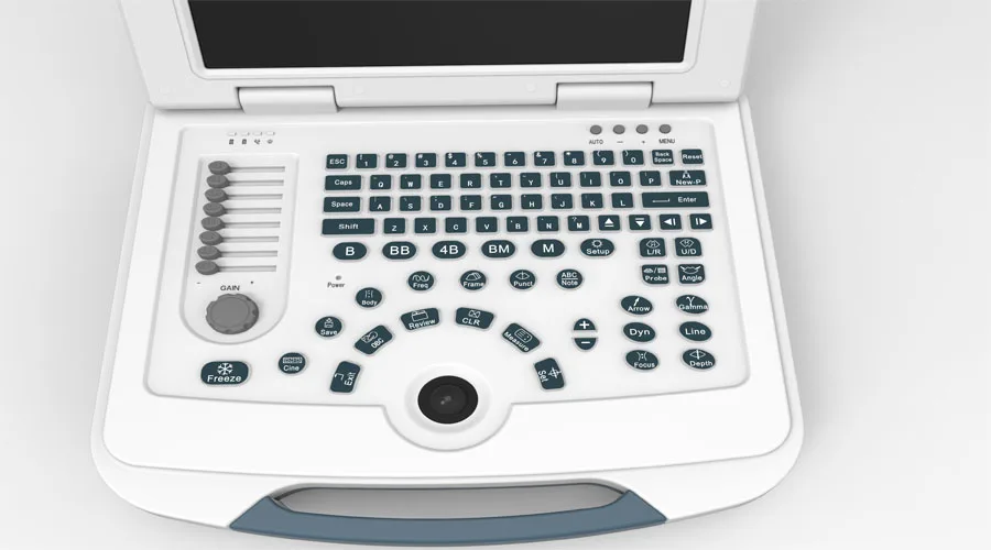 2017 New Portable & Laptop Ultrasound Machine With Convex Probe Dw580