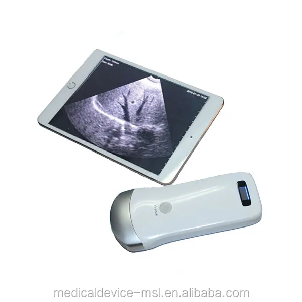 Handheld Usb Free Wireless Ultrasound Probe For Ipad & Iphone Mslpu31s