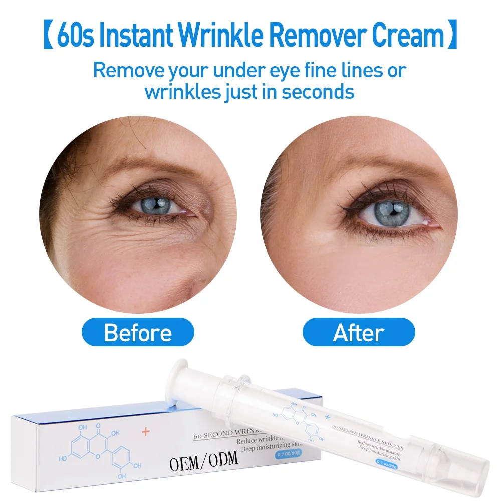 eye wrinkle remover