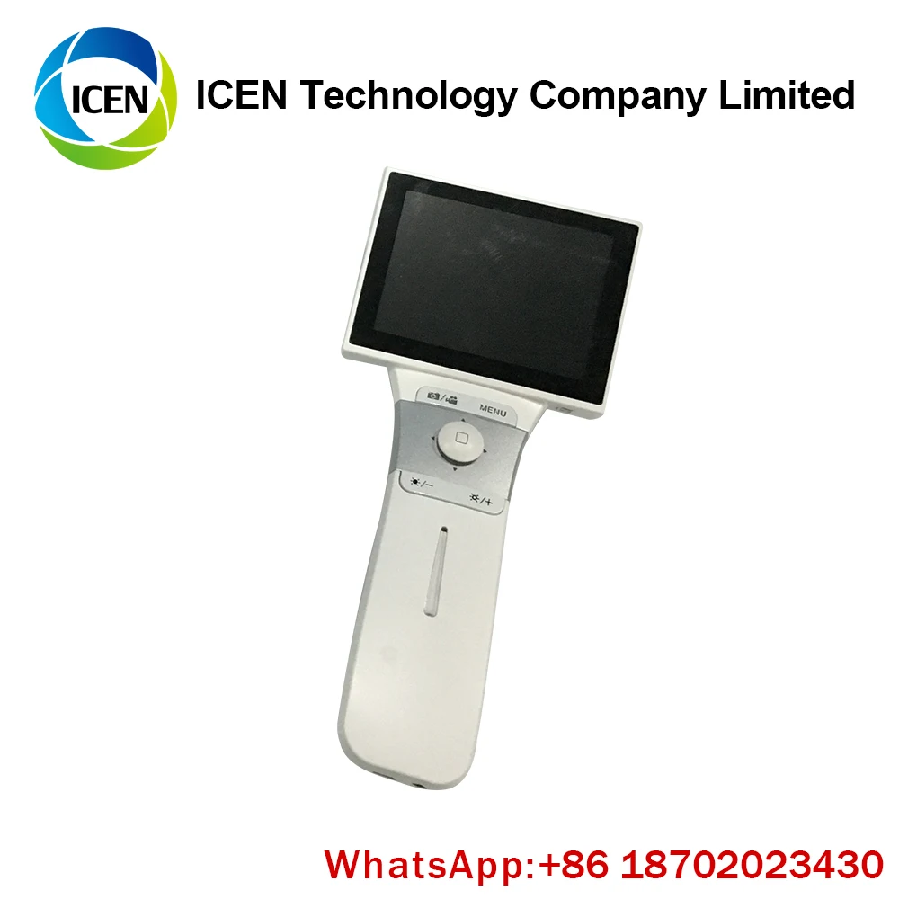 handheld fundus camera