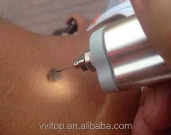 House Use Beauty Salon Skin Cautery Machine Mole Repeller Spot House Use Beauty Salon Skin Cautery Machine Mole Repeller Spot Removal