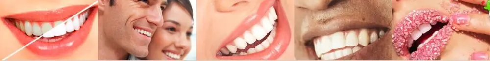 most popular Europe 4.5ml non peroxide teeth whitening gel