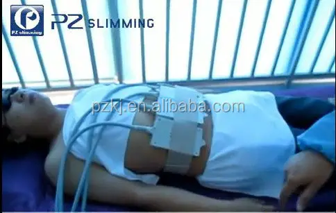 Caralluma posologia picture 2