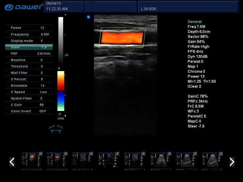 Doppler color Ultrasonido equipos portable ipad ultrasound Scanner Hospital Equipment