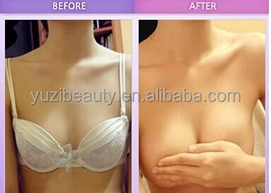 vacuum enlargement breast