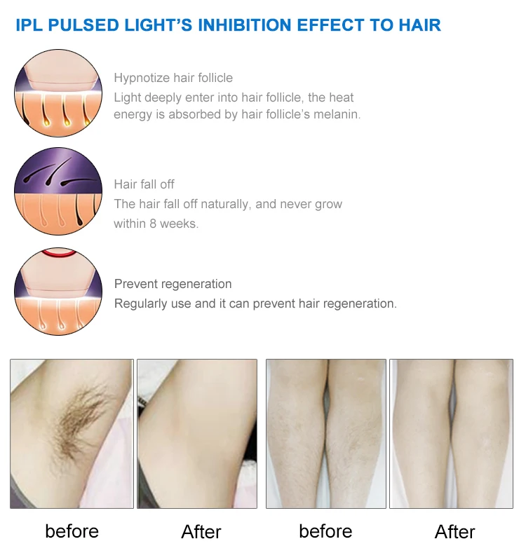 IPL&SHR Permanent Hair Removal Skin Rejuvenation Beauty Machine