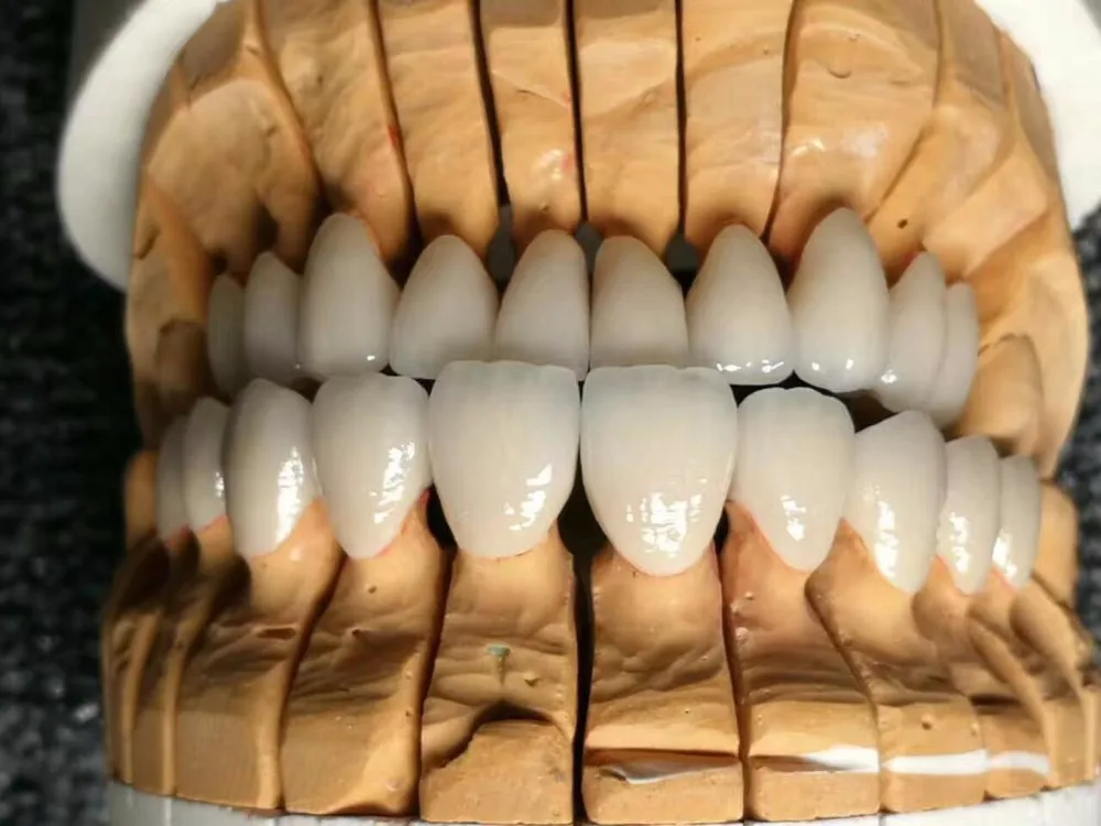 dental zirconia blocks (11)