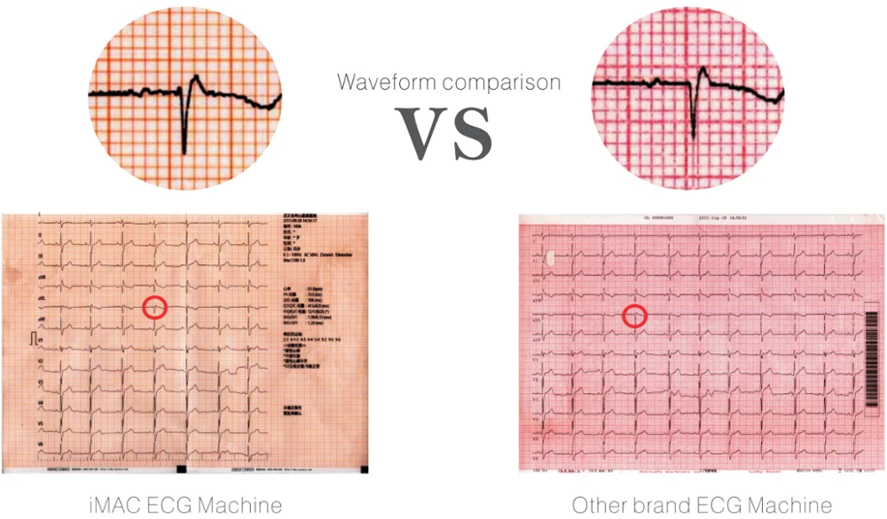 Pad ecg machine home ecg machine portable ecg machine