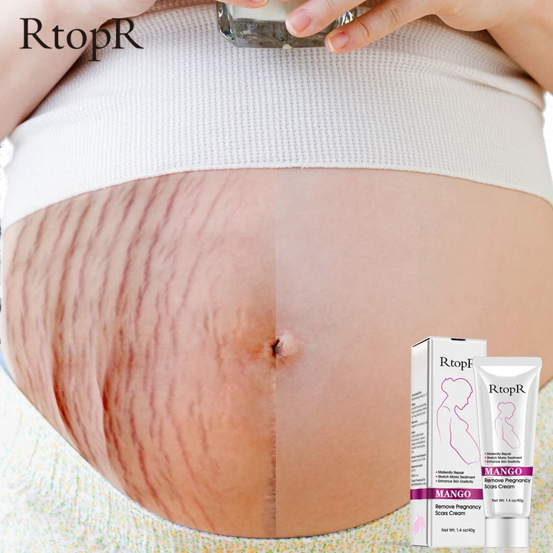 rose remove stretch marks cream