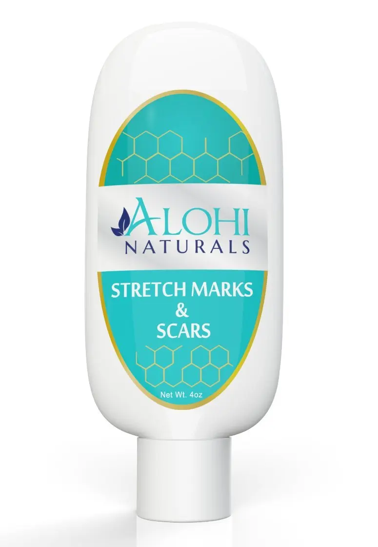 elovera cream for stretch marks