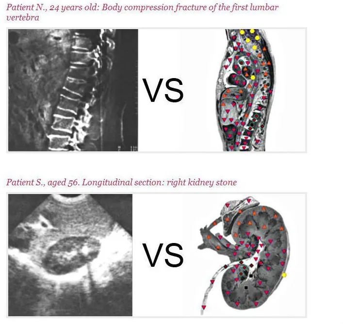 专业 8d nls 全身健康分析仪与生物树脂软件