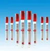 /product-detail/urine-whole-blood-serum-swab-specimen-used-vacuum-blood-tube-60210398053.html