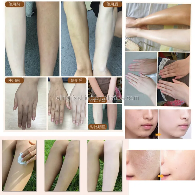 before and after.jpg