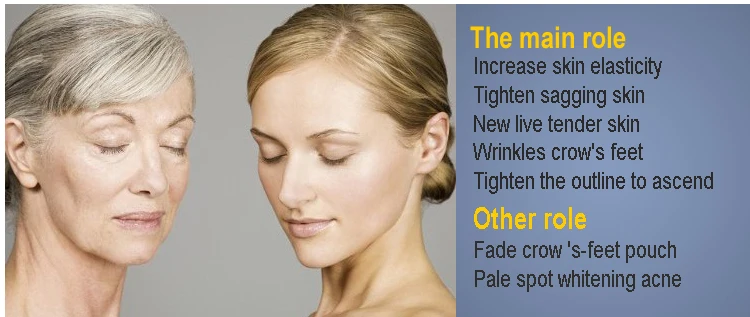 professional thermagic fractional rf skin tightening machine/radio frequency facial machine for sale