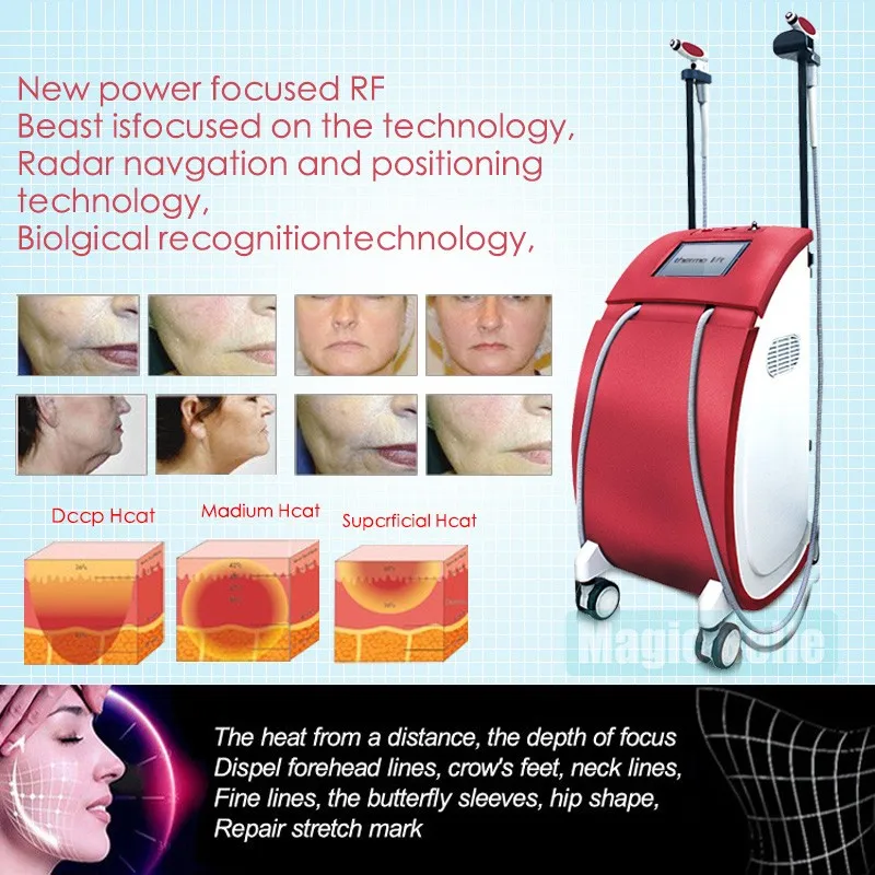 Thermo Lift Machine Skin Rejuvenation Rf Machine Face And Body Lifting