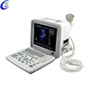 Portable B&W Ultrasound Machine For Pregnancy