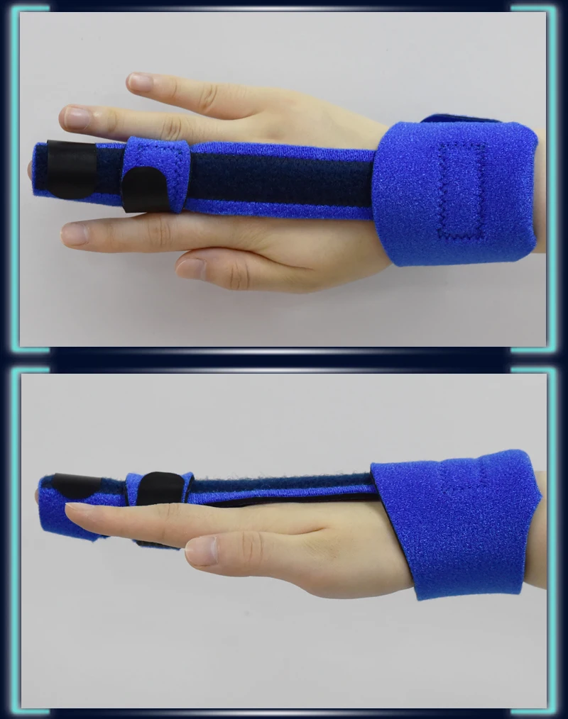 Finger-splint-GS394_03