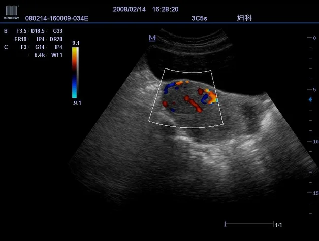 Portable 3D Doppler Ultrasound Machine Ultrasonography