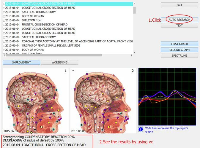 专业 8d nls 全身健康分析仪与生物树脂软件