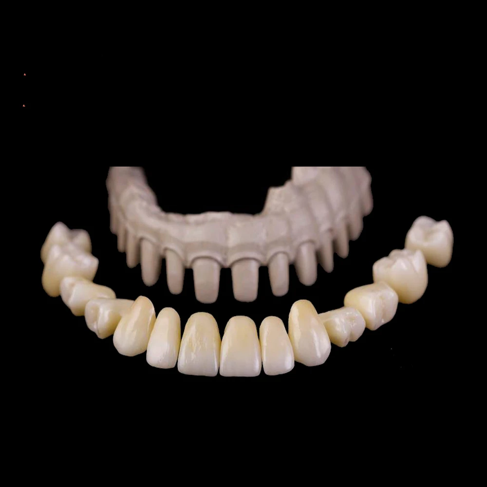 peek material in dentistry