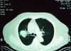 ct scan machine,medical thermal imaging camera,agfa film dt2b