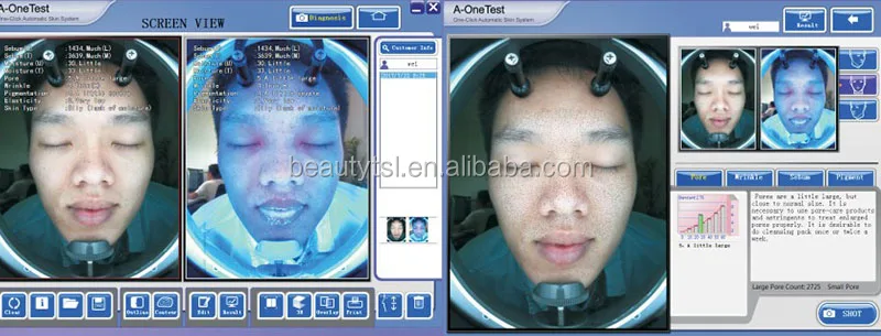 M8000 skin analyzer 2