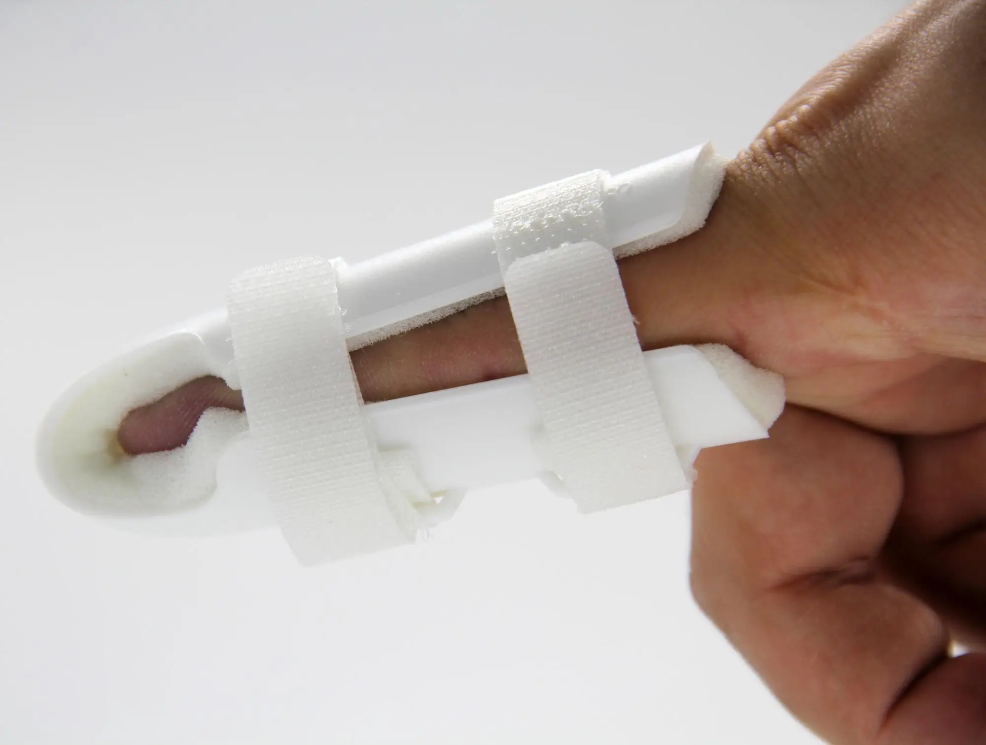 专业铝槌手指夹板用于手指矫正