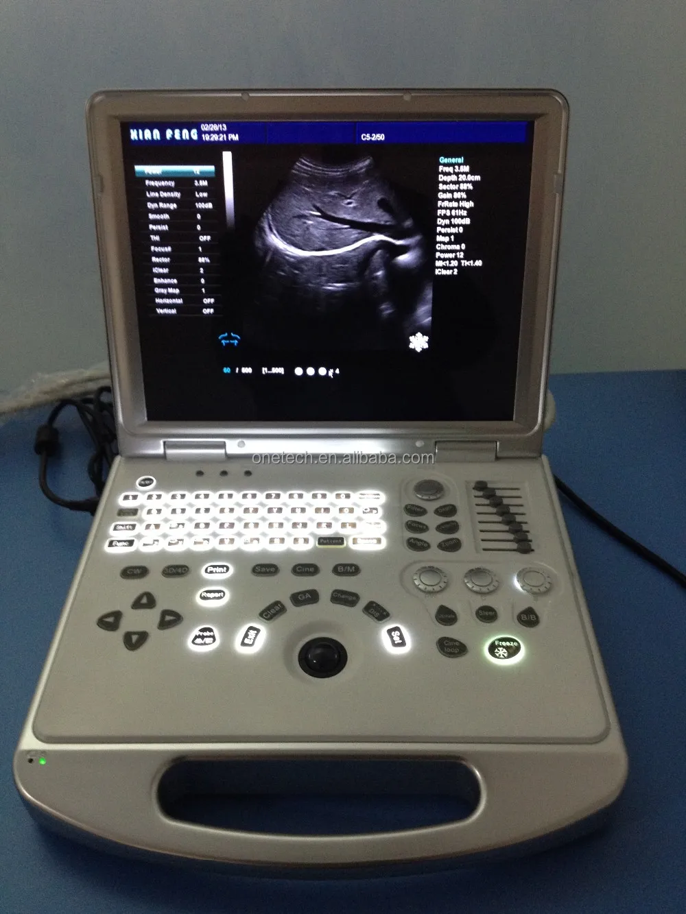 doppler ultrasound pregnancy