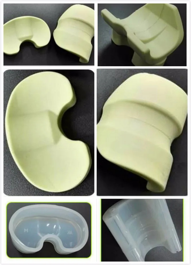 Knee Joint Bone Cement Spacer Mold For Revision Knee Arthroplasty