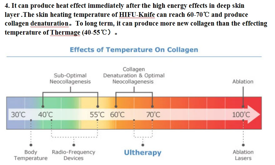 Skin temperature. Алгоритм Ulthera таблица.