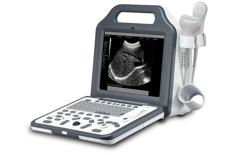 全数字超声波机/超声波扫描仪为医院销售