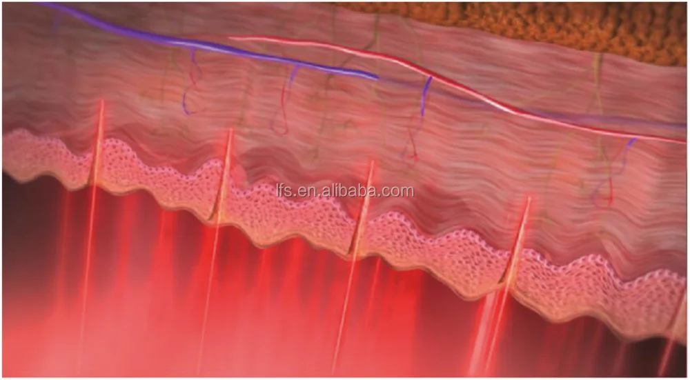 {~B53TSPIO2779H3LQR68