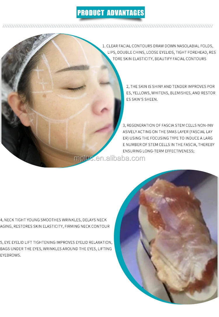 Most effective wrinkle removal skin tightening hifu face lift beauty machine