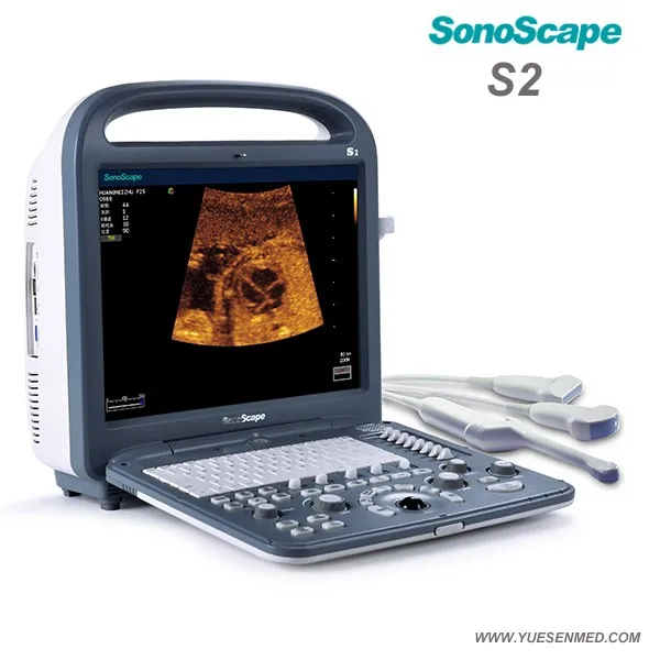SonoScape ultrasound