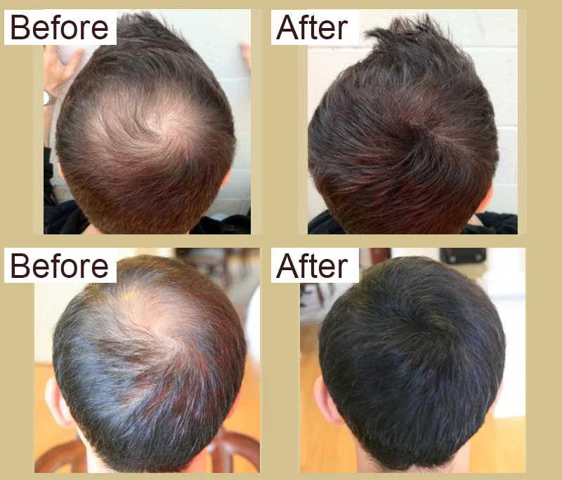 100 Natural Hair Wild Growth Oil For Men With Ginger Ingredient