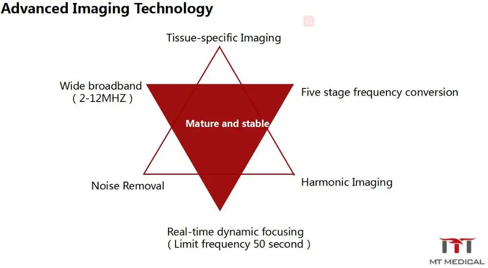 Black white Ultrasound Machine Cheap Ultrasound Machine B ultrasound Machine
