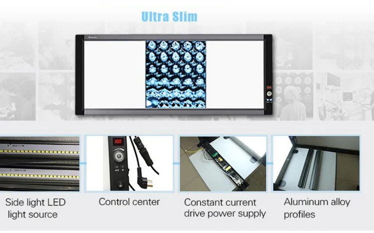 x-ray film viewer led x-ray film light box medical led x ray negatoscope