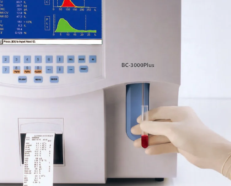 Анализатор анализов. Миндрей гематологический анализатор 3000. Анализатор Mindray BC- 3000plus. Автоматический гематологический анализатор BC-3000plus. Анализатор крови Mindray BC 3000.
