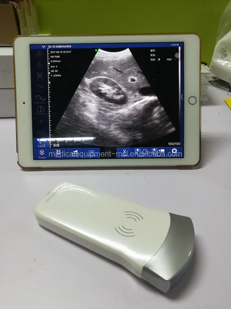 Mslpu40 128 Elements Usg Ultrasound Probe For Iphone & Ipad,Ipad