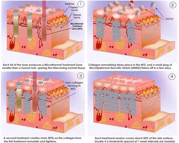 fractional principle
