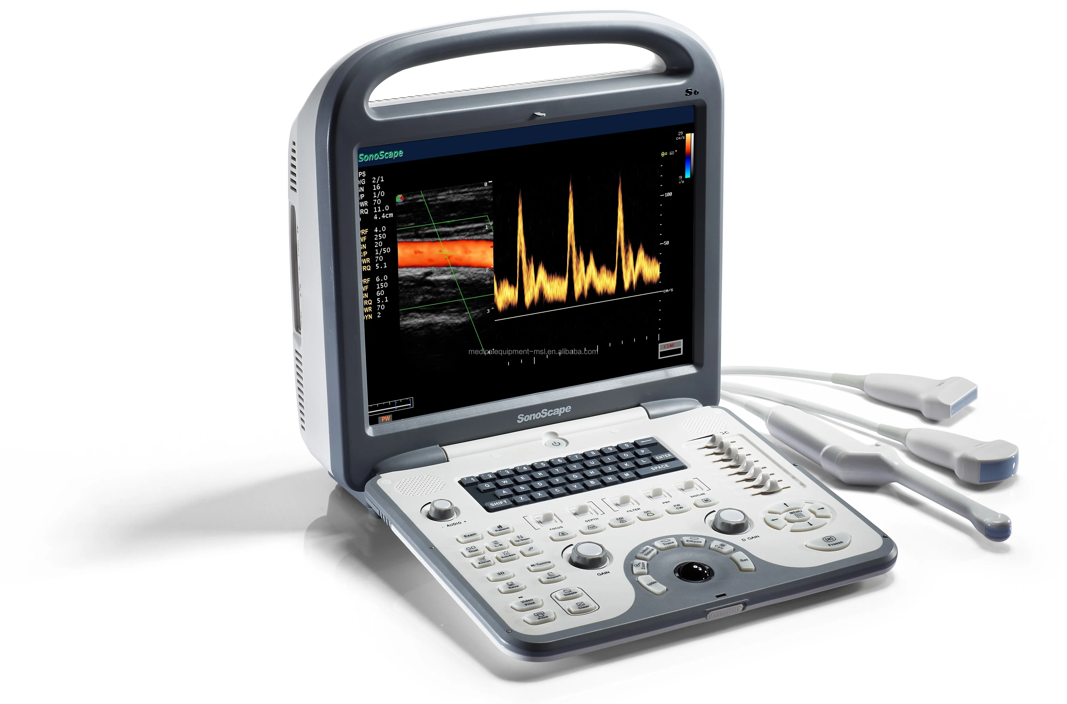 Medsinglong Ultrasound Machine Echocardiography,4d Ultrasound Machine